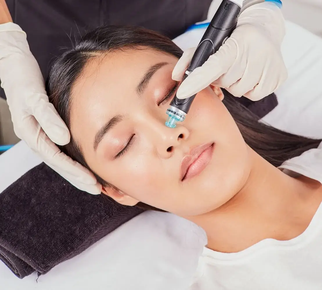 HydraFacial serum treatment at Aries Clinic
